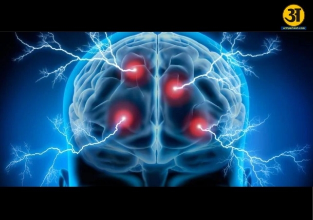 Common epilepsy misunderstandings debunked by medical expert