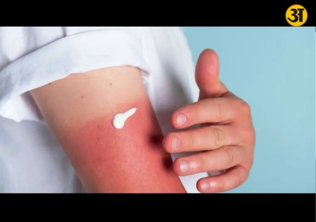 Doctors warn harsh sunlight may quietly damage skin beyond tanning