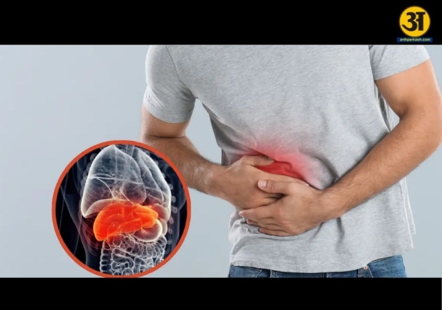 Fatty liver is not only caused by alcohol