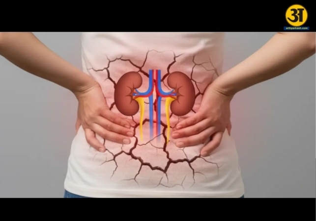 Hidden dehydration during monsoon can silently harm your kidneys