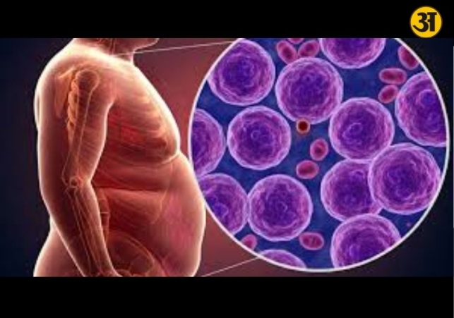 How obesity is increasing the risk of cancer worldwide