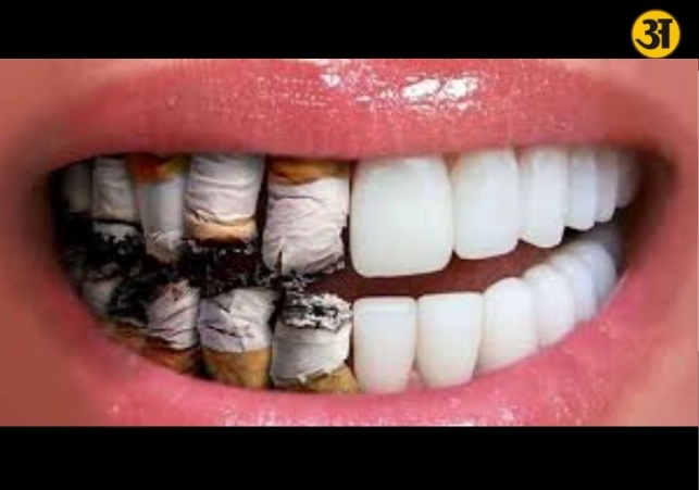 How stress sugar and smoking are damaging oral health in modern life