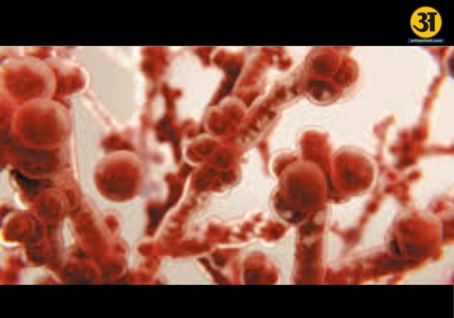 Invasive fungal infections can turn deadly if ignored early