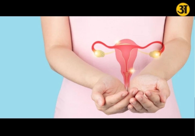PCOS symptoms 