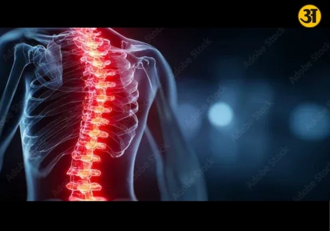 Persistent back pain may sometimes signal a spinal tumour doctors warn