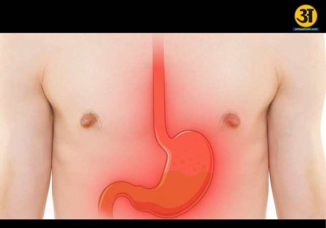 When heartburn signals a deeper issue