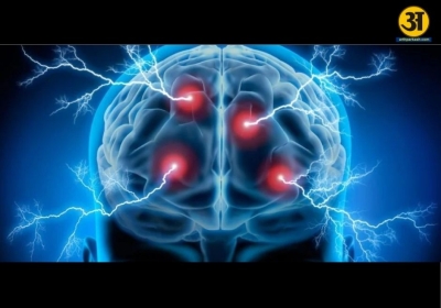 Common epilepsy misunderstandings debunked by medical expert