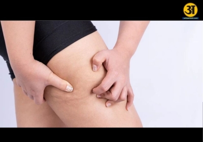 Common mistakes that can make inner thigh chafing worse
