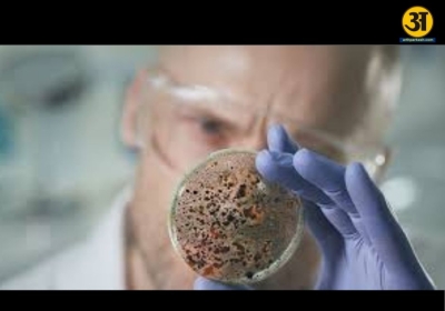 Doctors warn of rising fungal infections misdiagnosed as bacterial pneumonia