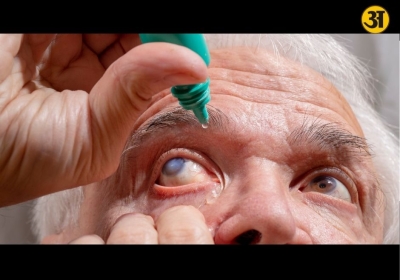 Living with glaucoma