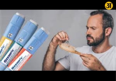 Ozempic use and hair loss