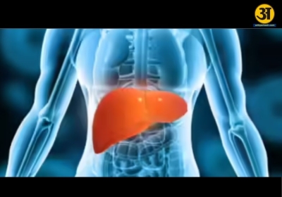 The hidden connection between diabetes and fatty liver disease explained by experts