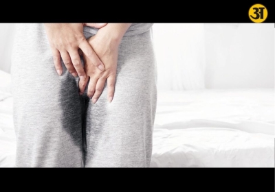 Urine leaks while laughing or sneezing are common