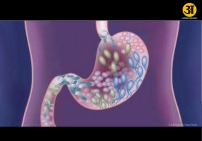 Want better gut health