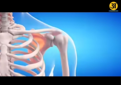 What happens to womens bone density after 35 and why it matters early