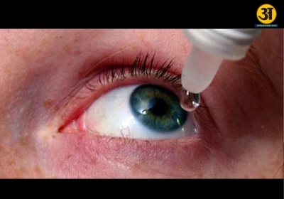 Why dry eyes can become a problem during the monsoon and how to protect your vision