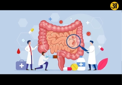 Why gut health matters more than digestion and how it may affect the whole body